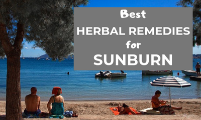 Best Herbal Remedies for Sunburn